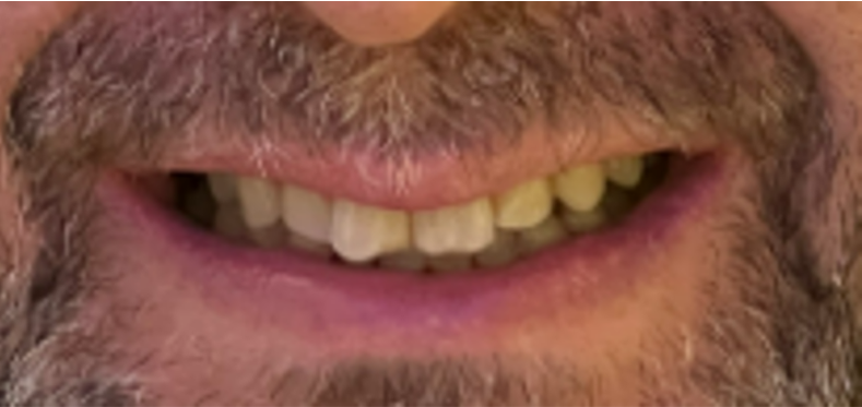 א.י. חיוך לפני