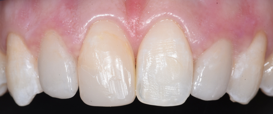 ב.ש. שיניים אחרי