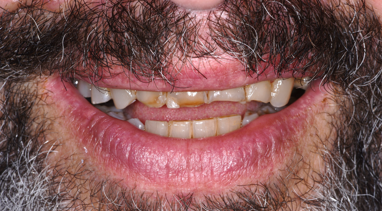 ז.י. חיוך לפני