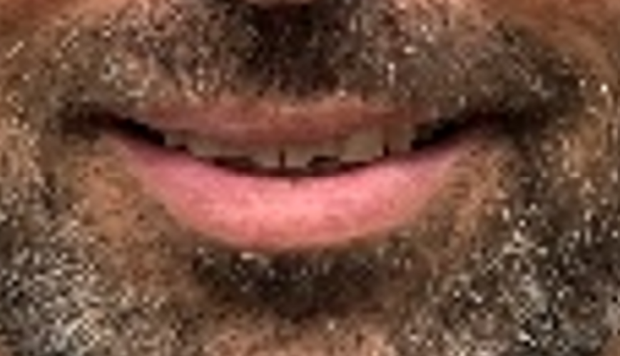 י.ח. חיוך לפני