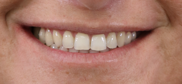 כ.ג חיוך אחרי