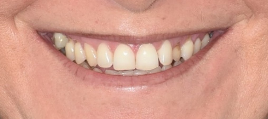 כ.ג חיוך לפני