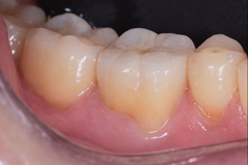 כ.ג. שיניים אחרי