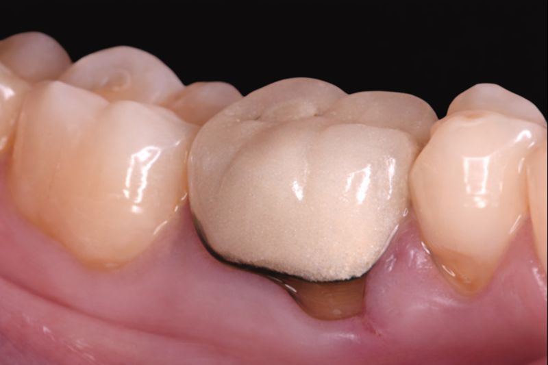 כ.ג. שיניים לפני