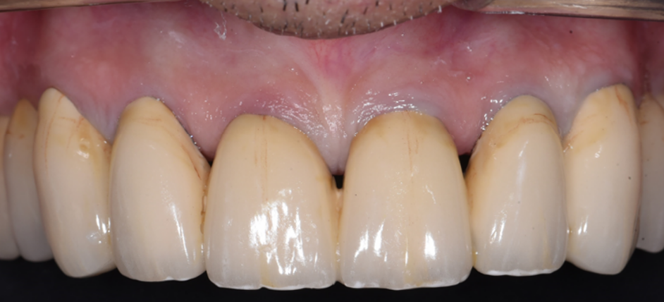 ל.א. שיניים אחרי