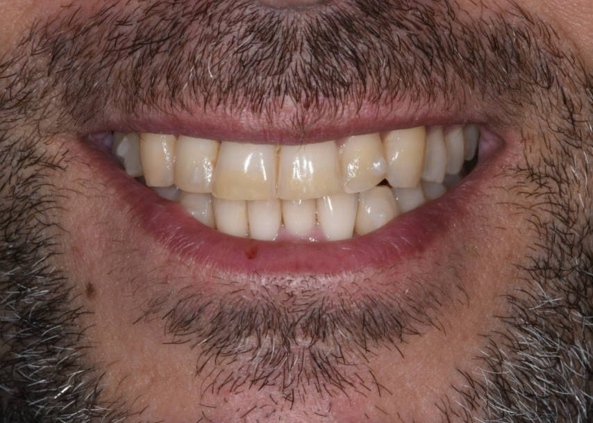 מ.ע. חיוך אחרי